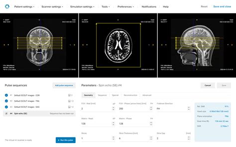 cosmid. com|Corsmed – MRI Simulator with True